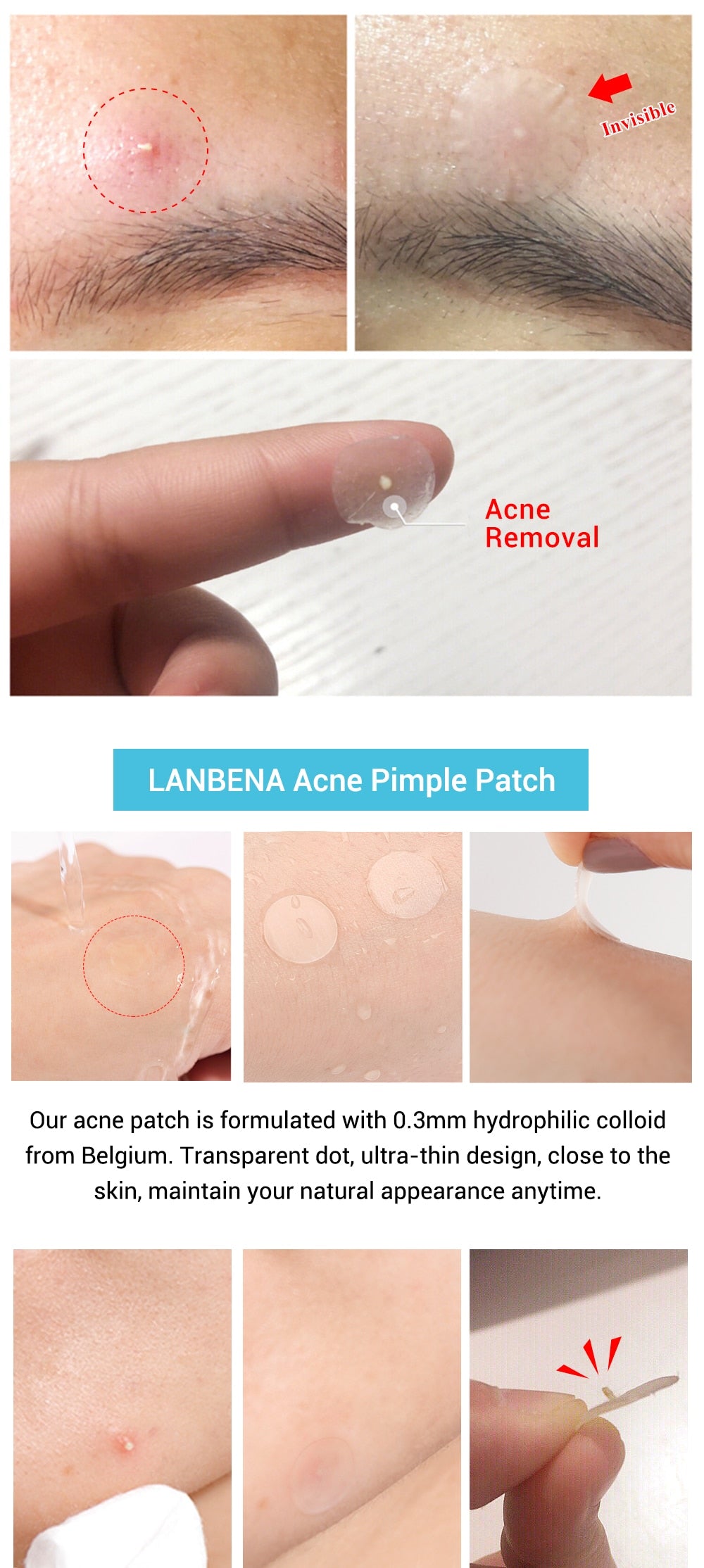 Acne Pimple Patch Face Mask 28pcs Invisible Acne Stickers Blemish Treatment Pimple Remover Tool Skin Care Face Cream