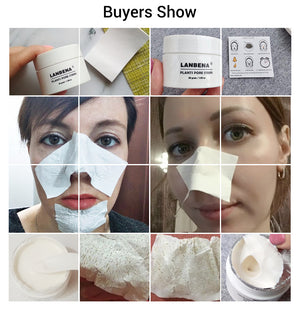 Blackhead Remover Face Mask Pore Strip Black Peeling Nose Mask Acne Treatment Unisex Deep Cleansing Skin Care Beauty